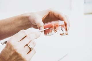 Dinți ficși implant – metodă rapidă și fixă într-o zi